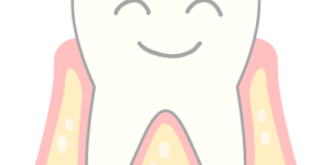歯周病のメンテナンス